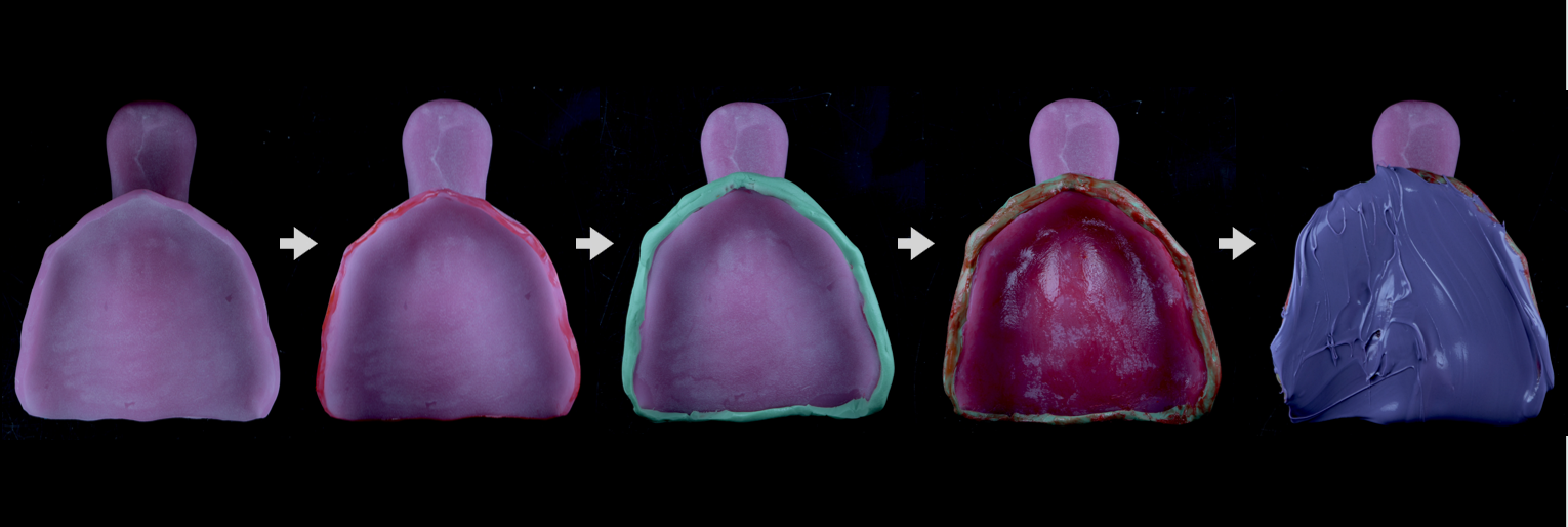 Five dental impression trays are shown in a left-to-right sequence, each displaying different colored materials applied in progression, indicating impression-taking steps.