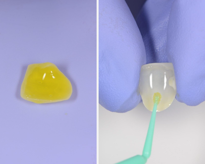 close-up of a single veneer backside and two fingers holding the veneer applying adhesive with a micro brush