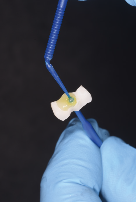 A close-up of a gloved hand holding a dental tool applying light-cured material on a small, butterfly-shaped dental mold against a dark background.