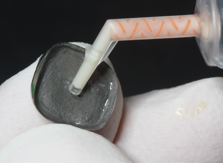 Close-up of a dental tool applying a liquid to a black dental mold held by white gloves