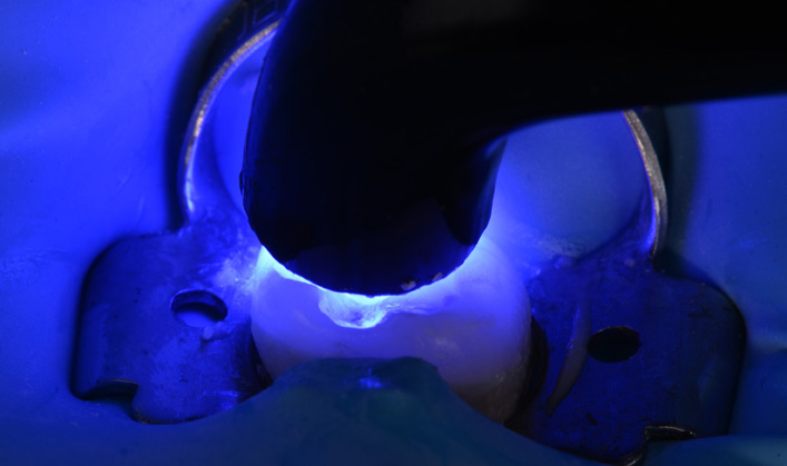 Close-up of a handcuff locking mechanism illuminated by blue light