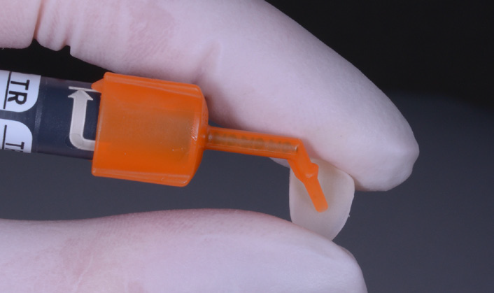 Gloved hand holding a syringe with an orange angled tip
