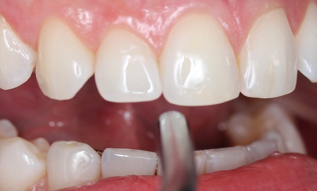 close up or air removing excess adhesive