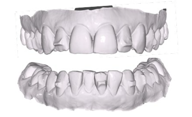 side image