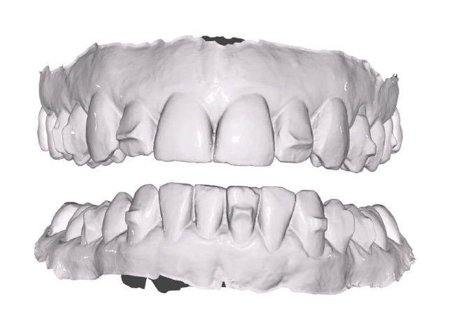 side image