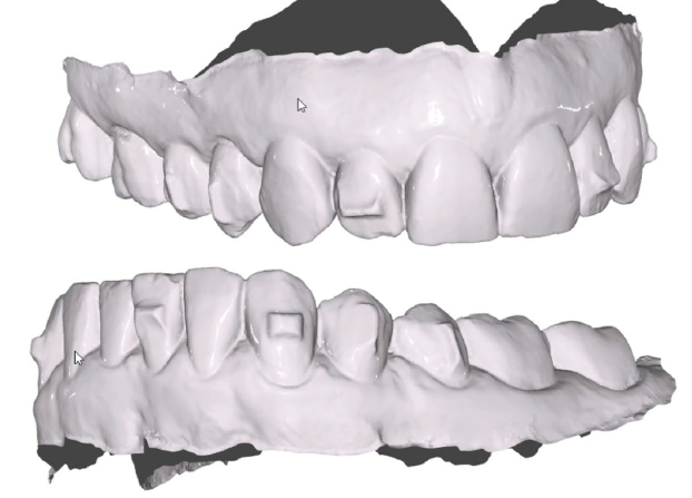 side image