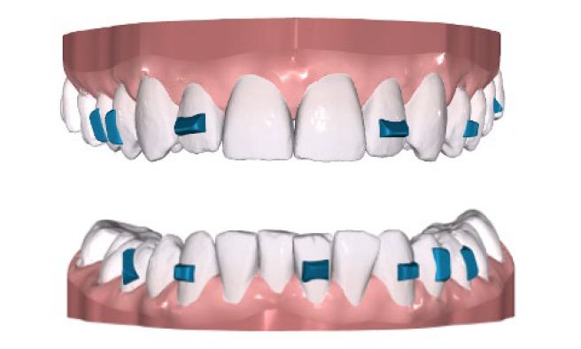 side image