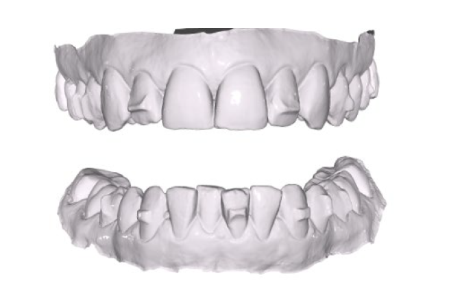 side image