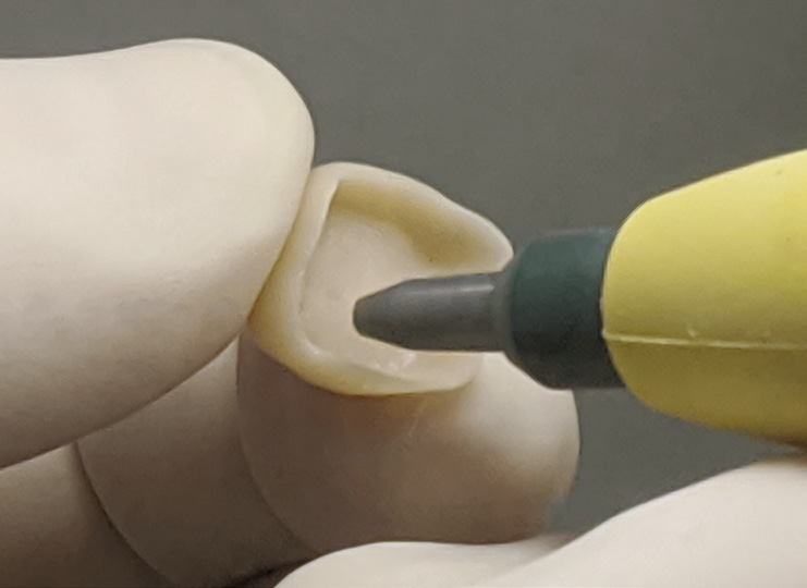 Gloved hand holding a tooth model with a dental tool inserted into a cavity