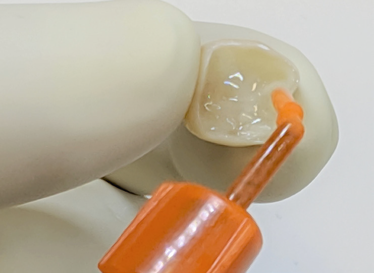 Gloved hand holding a tooth model with an orange applicator applying liquid to the tooth surface